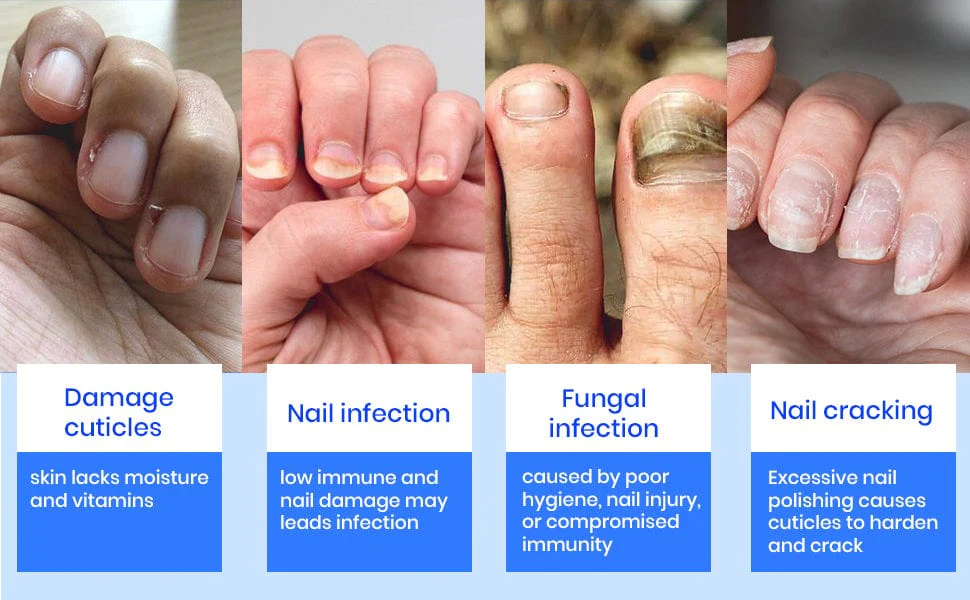 D-fame Advanced Nail Repair Serum - Image 10