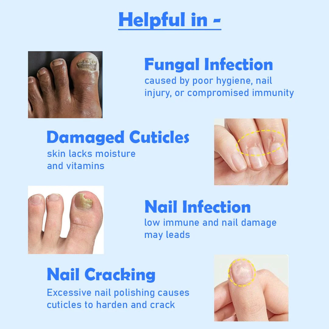 D-fame Advanced Nail Repair Serum - Image 5