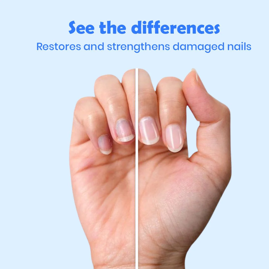 D-fame Advanced Nail Repair Serum - Image 8