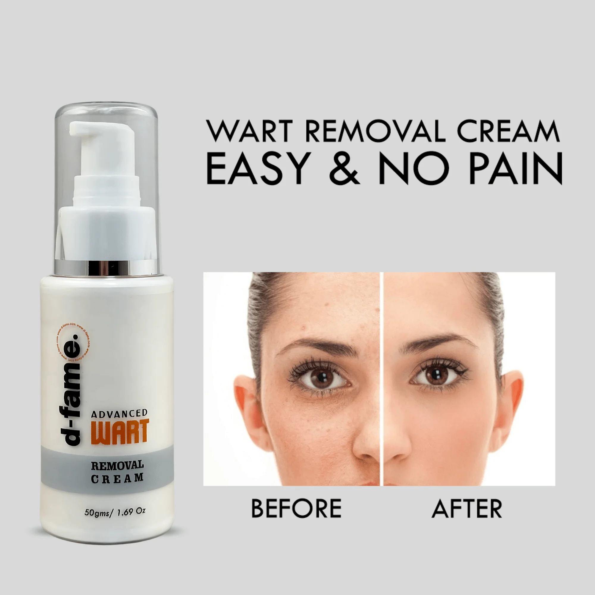 D-Fame Advanced Wart Removal Cream - Image 4
