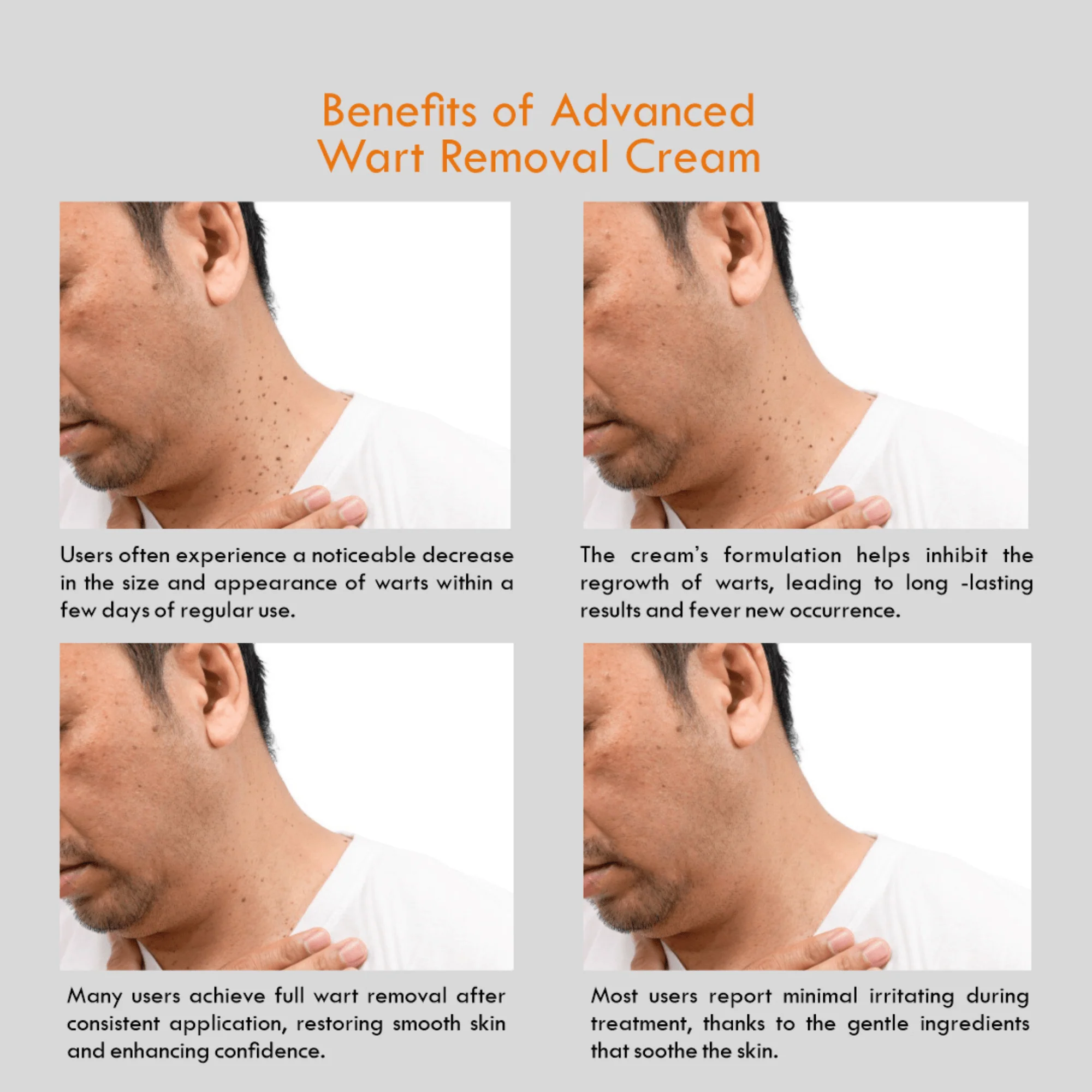 D-Fame Advanced Wart Removal Cream - Image 7