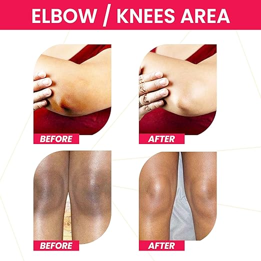 Fade & Fix - Vitamin C Dark Area Corrector and Removal for Dark Underarms & Knee - 50 ml - Image 6